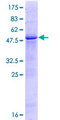 GGTLA4 / GGTLC1 Protein - 12.5% SDS-PAGE of human GGTLA4 stained with Coomassie Blue