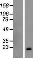 GH / Growth Hormone Protein - Western validation with an anti-DDK antibody * L: Control HEK293 lysate R: Over-expression lysate