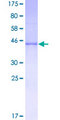 GH / Growth Hormone Protein - 12.5% SDS-PAGE of human GH1 stained with Coomassie Blue