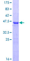 GH2 Protein - 12.5% SDS-PAGE of human GH2 stained with Coomassie Blue