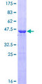 GH2 Protein - 12.5% SDS-PAGE of human GH2 stained with Coomassie Blue