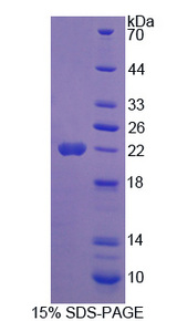 GH2 Protein - Recombinant Growth Hormone 2 By SDS-PAGE