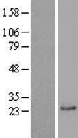 GHBP / BLVRB Protein - Western validation with an anti-DDK antibody * L: Control HEK293 lysate R: Over-expression lysate