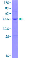 GHBP / BLVRB Protein - 12.5% SDS-PAGE of human BLVRB stained with Coomassie Blue