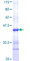 GHBP / BLVRB Protein - 12.5% SDS-PAGE Stained with Coomassie Blue.