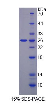 GHBP / BLVRB Protein - Recombinant  Biliverdin Reductase B By SDS-PAGE