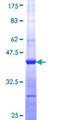 GHDC Protein - 12.5% SDS-PAGE Stained with Coomassie Blue.