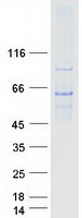 GHDC Protein - Purified recombinant protein GHDC was analyzed by SDS-PAGE gel and Coomassie Blue Staining