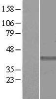 GHITM Protein - Western validation with an anti-DDK antibody * L: Control HEK293 lysate R: Over-expression lysate