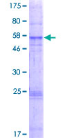GHITM Protein - 12.5% SDS-PAGE of human GHITM stained with Coomassie Blue