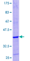 GHRH Protein - 12.5% SDS-PAGE of human GHRH stained with Coomassie Blue