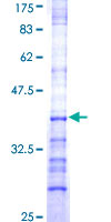 GHRH Protein - 12.5% SDS-PAGE Stained with Coomassie Blue.