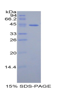 GHRH Protein - Recombinant Growth Hormone Releasing Hormone By SDS-PAGE