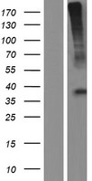 GHRHR Protein - Western validation with an anti-DDK antibody * L: Control HEK293 lysate R: Over-expression lysate