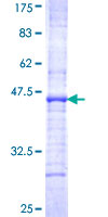 GHRHR Protein - 12.5% SDS-PAGE Stained with Coomassie Blue.