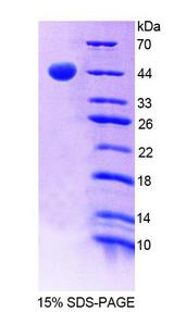 GHRHR Protein - Recombinant Growth Hormone Releasing Hormone Receptor By SDS-PAGE