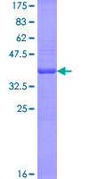 GHRL / Ghrelin Preproprotein Protein - 12.5% SDS-PAGE of human GHRL stained with Coomassie Blue