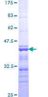 GHRL / Ghrelin Preproprotein Protein - 12.5% SDS-PAGE Stained with Coomassie Blue.