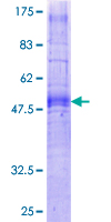 GHSR / Ghrelin Receptor Protein - 12.5% SDS-PAGE of human GHSR stained with Coomassie Blue