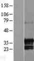 GID4 Protein - Western validation with an anti-DDK antibody * L: Control HEK293 lysate R: Over-expression lysate