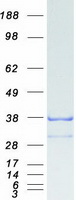 GID4 Protein - Purified recombinant protein GID4 was analyzed by SDS-PAGE gel and Coomassie Blue Staining