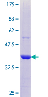 GIF / Intrinsic Factor Protein - 12.5% SDS-PAGE Stained with Coomassie Blue.