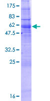 GIMAP2 Protein - 12.5% SDS-PAGE of human GIMAP2 stained with Coomassie Blue