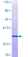 GIMAP2 Protein - 12.5% SDS-PAGE Stained with Coomassie Blue.