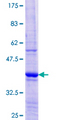 GIMAP5 Protein - 12.5% SDS-PAGE Stained with Coomassie Blue.