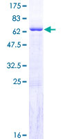 GIMAP6 Protein - 12.5% SDS-PAGE of human GIMAP6 stained with Coomassie Blue