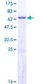 GIMAP6 Protein - 12.5% SDS-PAGE of human GIMAP6 stained with Coomassie Blue