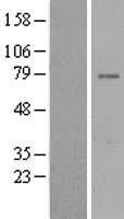 GIMAP8 Protein - Western validation with an anti-DDK antibody * L: Control HEK293 lysate R: Over-expression lysate