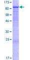GIMAP8 Protein - 12.5% SDS-PAGE of human GIMAP8 stained with Coomassie Blue