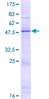 GIN1 Protein - 12.5% SDS-PAGE of human GIN1 stained with Coomassie Blue