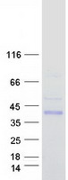 GINM1 / C6orf72 Protein - Purified recombinant protein GINM1 was analyzed by SDS-PAGE gel and Coomassie Blue Staining