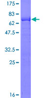 GINS1 / PSF1 Protein - 12.5% SDS-PAGE of human GINS1 stained with Coomassie Blue