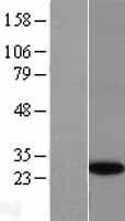 GINS4 / SLD5 Protein - Western validation with an anti-DDK antibody * L: Control HEK293 lysate R: Over-expression lysate