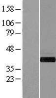 GIPC1 / GIPC Protein - Western validation with an anti-DDK antibody * L: Control HEK293 lysate R: Over-expression lysate