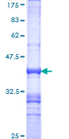 GIPC1 / GIPC Protein - 12.5% SDS-PAGE Stained with Coomassie Blue.