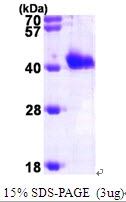 GIPC1 / GIPC Protein