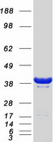 GIPC1 / GIPC Protein - Purified recombinant protein GIPC1 was analyzed by SDS-PAGE gel and Coomassie Blue Staining
