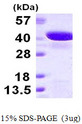 GIPC2 Protein