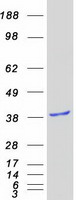 GIPC2 Protein - Purified recombinant protein GIPC2 was analyzed by SDS-PAGE gel and Coomassie Blue Staining