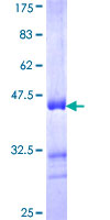 GIPC3 Protein - 12.5% SDS-PAGE Stained with Coomassie Blue.