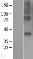 GIPR / GIP Receptor Protein - Western validation with an anti-DDK antibody * L: Control HEK293 lysate R: Over-expression lysate