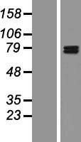 GIT1 Protein - Western validation with an anti-DDK antibody * L: Control HEK293 lysate R: Over-expression lysate