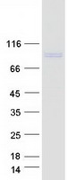 GIT1 Protein - Purified recombinant protein GIT1 was analyzed by SDS-PAGE gel and Coomassie Blue Staining