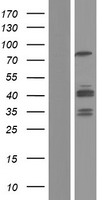 GIT2 Protein - Western validation with an anti-DDK antibody * L: Control HEK293 lysate R: Over-expression lysate