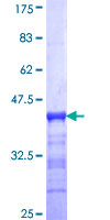 GIT2 Protein - 12.5% SDS-PAGE Stained with Coomassie Blue.
