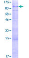 GJA10 / CX62 / Connexin 62 Protein - 12.5% SDS-PAGE of human GJA10 stained with Coomassie Blue